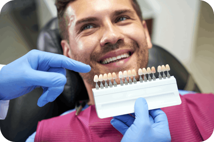 veneers