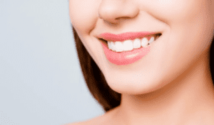 Do They Shave Down Your Teeth for Veneers?