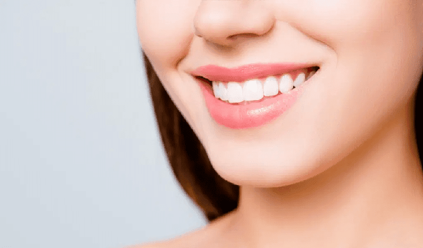 Do They Shave Down Your Teeth for Veneers?