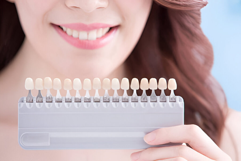 How Many Veneers Is a Full Set?