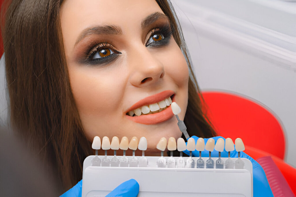 What Happens If You Don’t Like Your Veneers?
