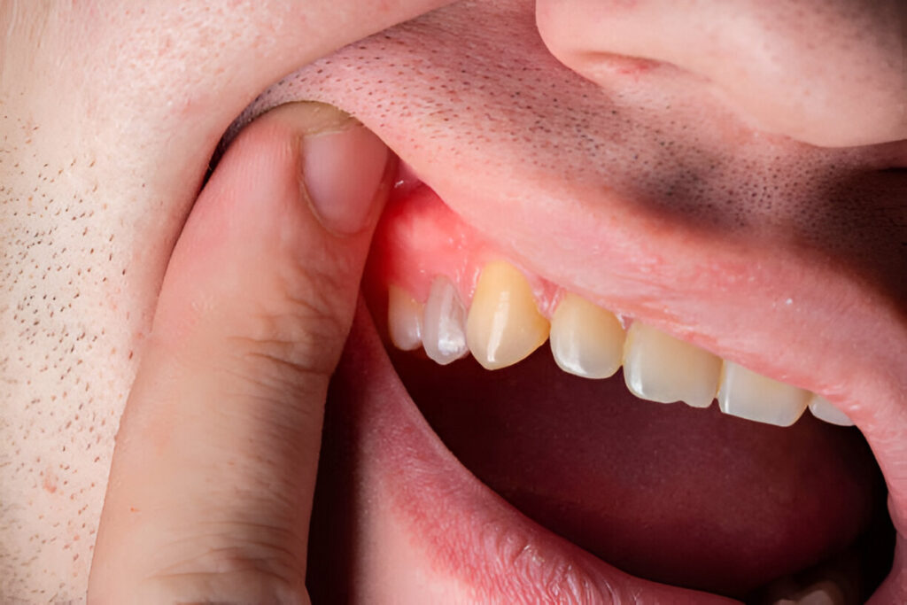 Urgent Dental Treatment in Aberdeen