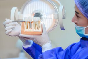 Dental Implants in Aberdeen